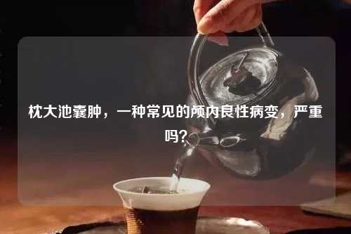 枕大池囊肿，一种常见的颅内良性病变，严重吗？