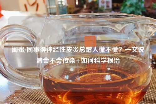 闺蜜/同事得神经性皮炎总蹭人慌不慌？一文说清会不会传染+如何科学根治