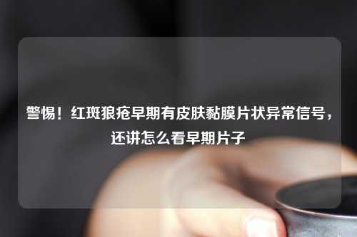 警惕！红斑狼疮早期有皮肤黏膜片状异常信号，还讲怎么看早期片子
