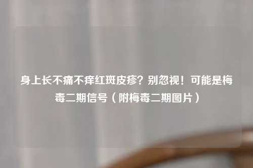 身上长不痛不痒红斑皮疹？别忽视！可能是梅毒二期信号（附梅毒二期图片）