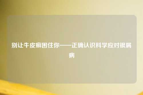 别让牛皮癣困住你——正确认识科学应对银屑病